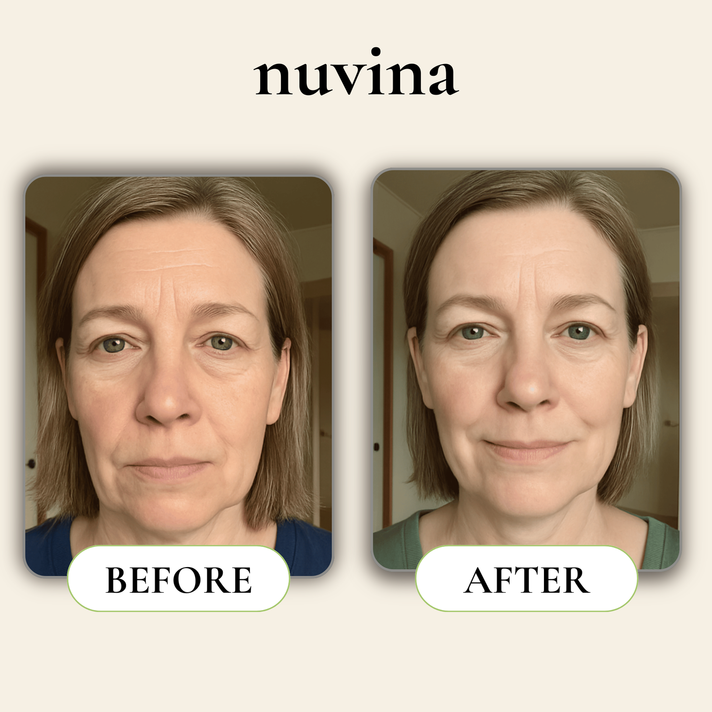 Nuvina Before & After Face