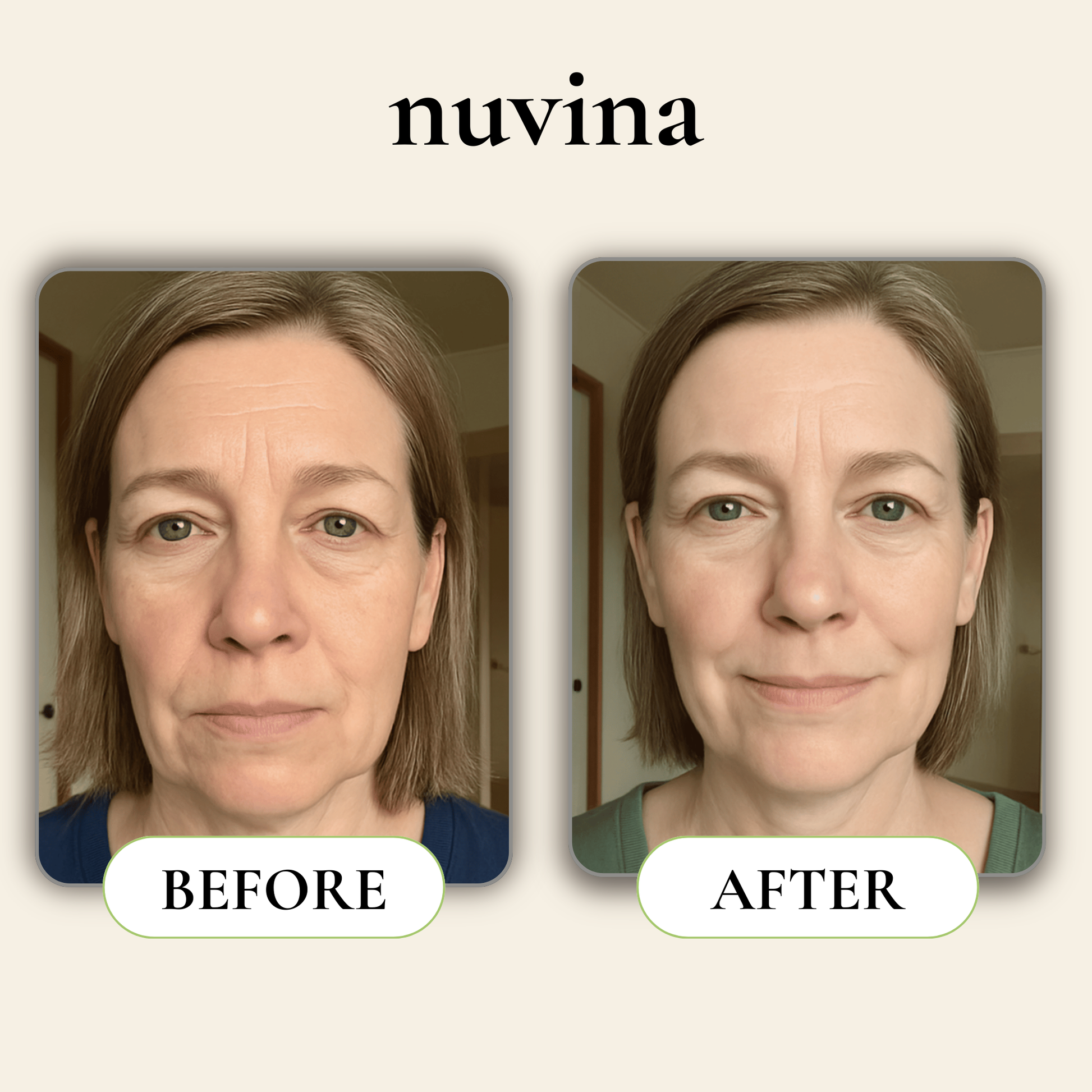 Nuvina Before & After Face